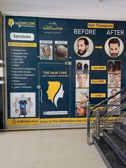 Peshawar Hair Transplant