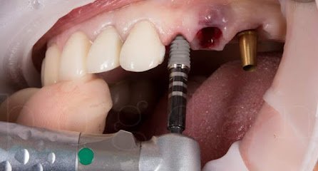 Defence Dental Implant & Maxillofacial Surgery Clinic