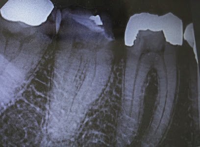 Zain Dental Clinic & Implant Center