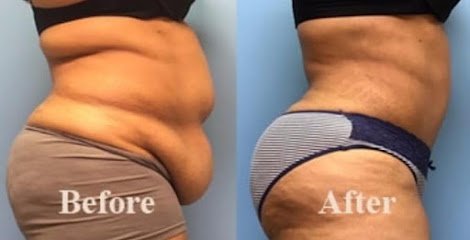Dr Salman Liposuction, Gynecomastia & Rhinoplasty Clinic