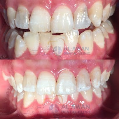 Al Awan Dental Clinic