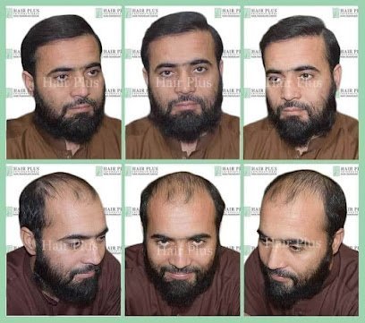 Hair Plus Hair Transplant Center