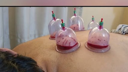 Al-Rafay Hijama Center