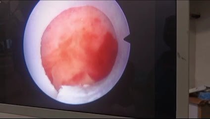 Advanced Kidney And Fertility Centre
