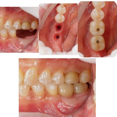 Leefort Dental Implant & Oral Surgery