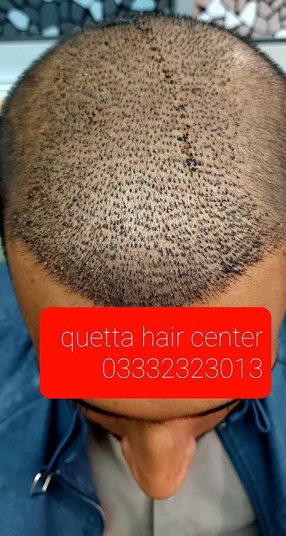 Quetta Hair Center Transplant
