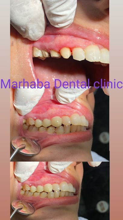 Marhaba Dental Clinic