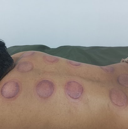 Alsunnah Hijama Center