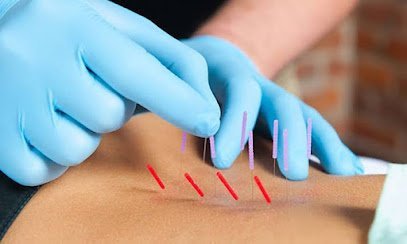 Physiotherapy, Dry Needling And Dry Cupping Therapy Center