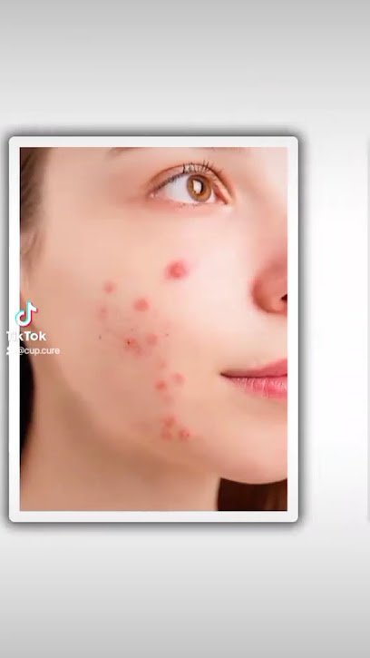 Cup Cure Cupping Therapy