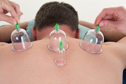 Shifa Hijama/Fire Cupping Center
