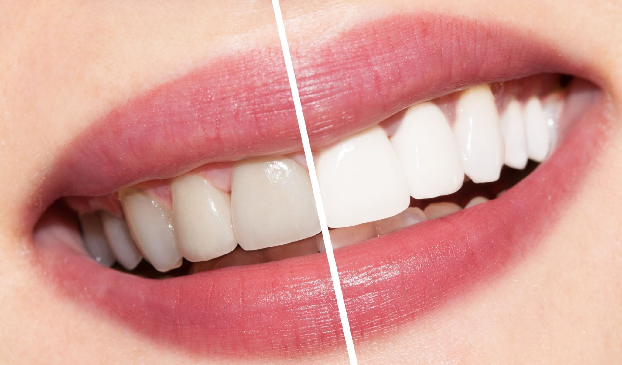 Dental Aesthetics Studio - Hospital