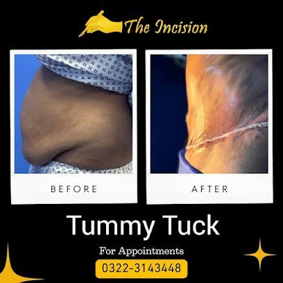 The Incision Clinic